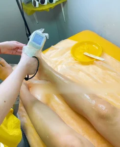 latest hair removal diode laser feedback (6)